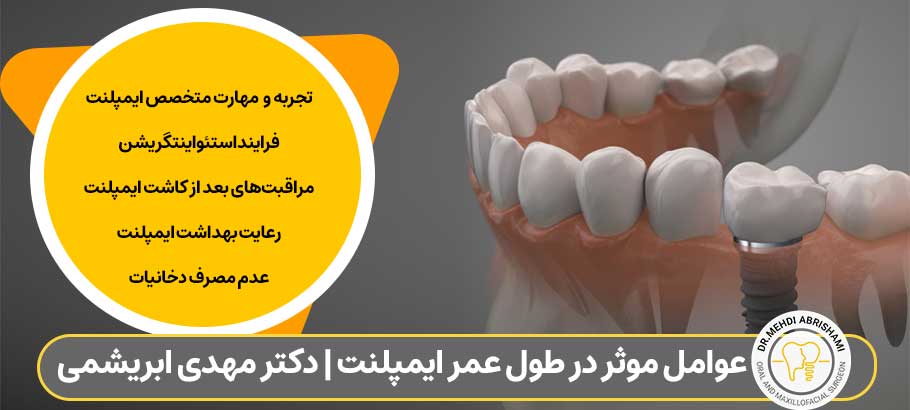 عوامل موثر در طول عمر ایمپلنت دندان