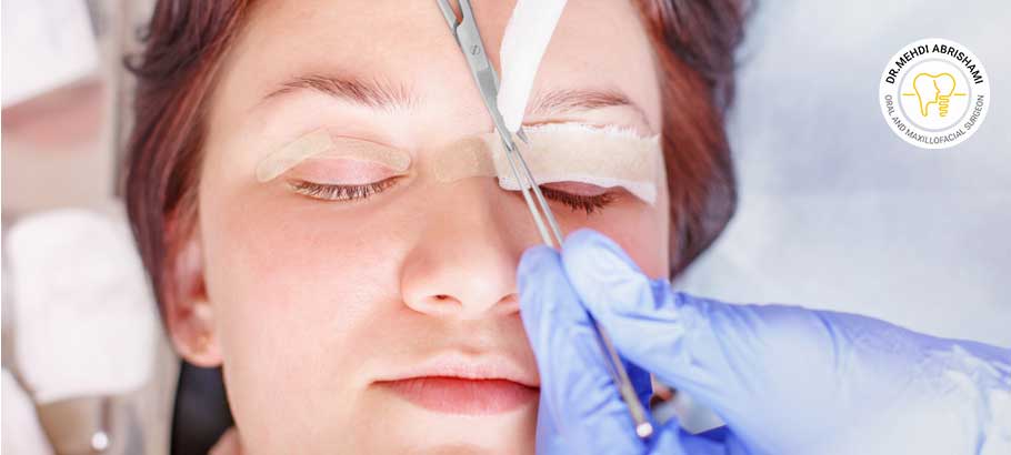 ماساژ چشم بعد از عمل پلک