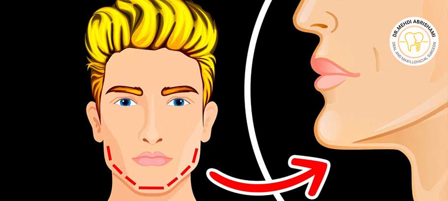 تمرینات تدریجی بعد از جراحی فک