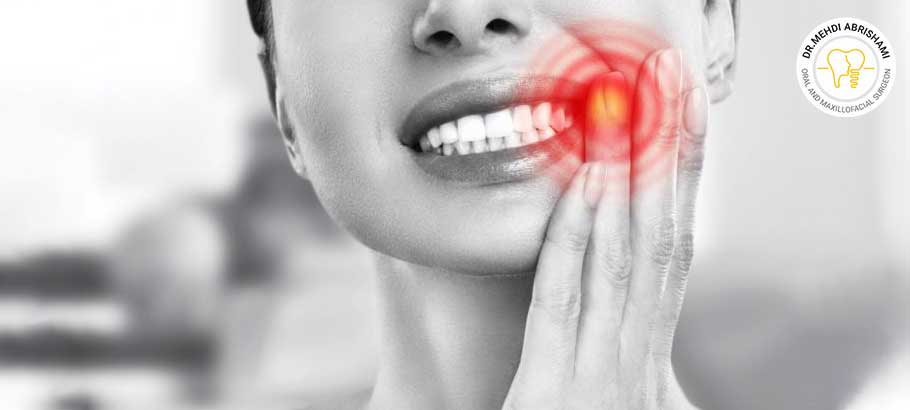 ایا کیست دندان باعث سرطان لثه میشود؟