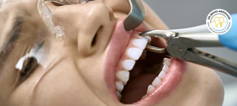 کشیدن دندان و خارج کردن کیست لثه