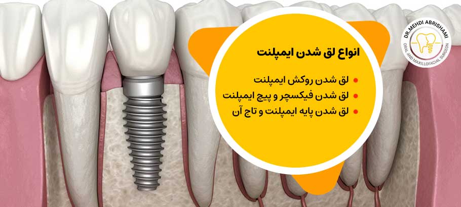 انواع مختلف لق شدن ایمپلنت دندان