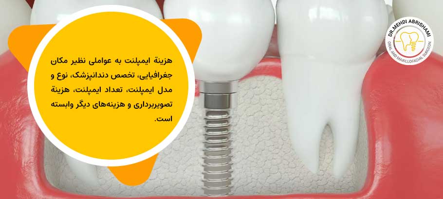 قیمت کاشت دندان دائمی