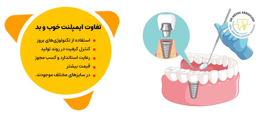 یک ایمپلنت خوب چه تفاوت‌هایی با ایمپلنت نامرغوب دارد؟