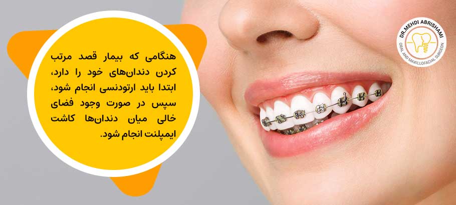 ارتودنسی پیش از قراردادن ایمپلنت باید انجام شود یا پس از ایمپلنت؟