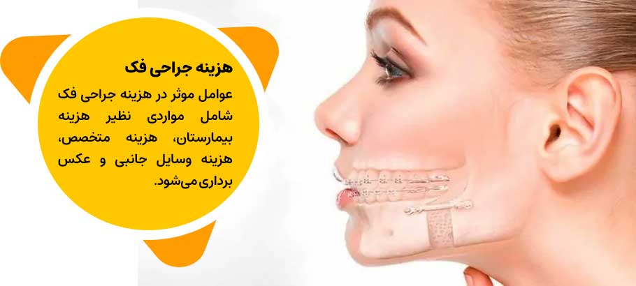 هزینه جراحی فک در اصفهان