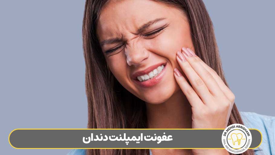 عفونت ایمپلنت دندان