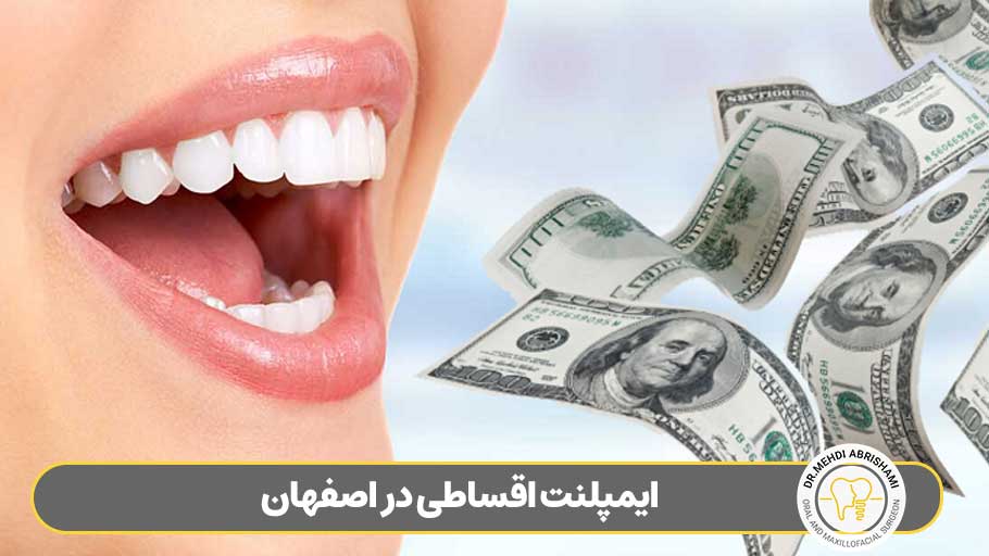 ایمپلنت دندان قسطی در اصفهان