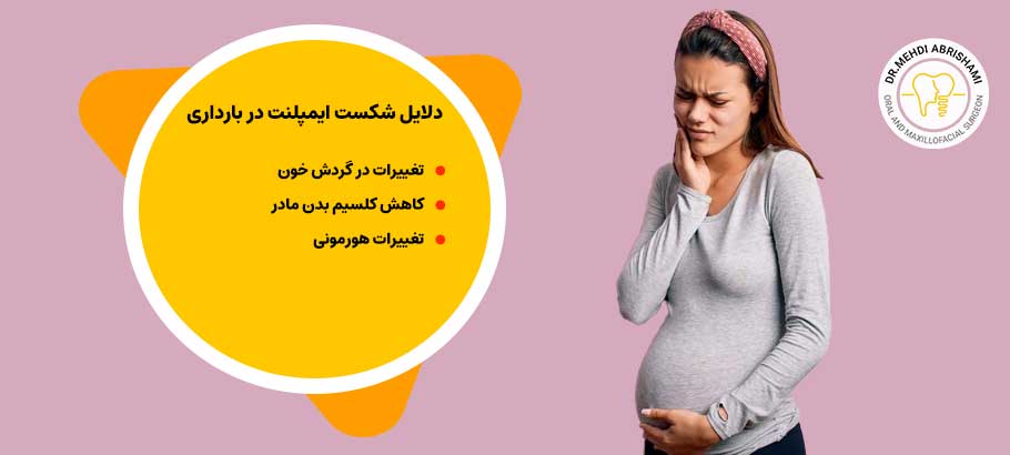 دلایل شکست ایمپلنت در بارداری