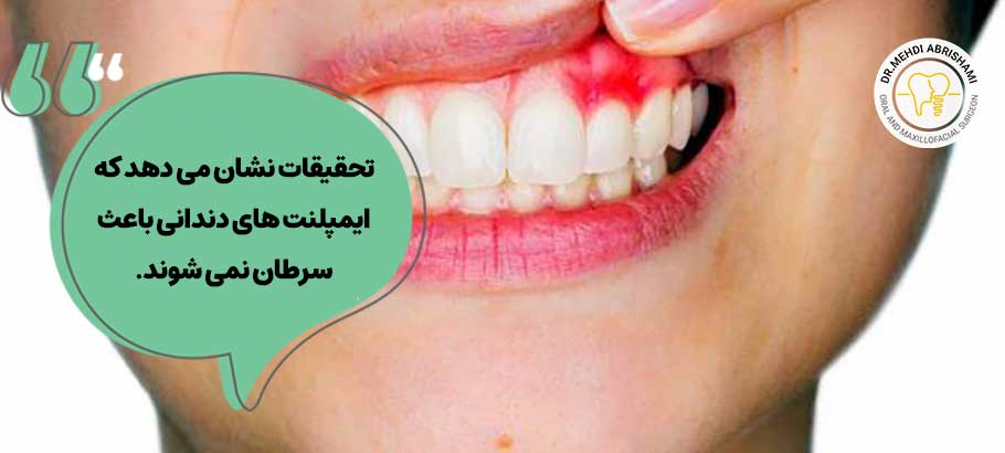 آیا ایمپلنت دندان باعث سرطان می شود؟