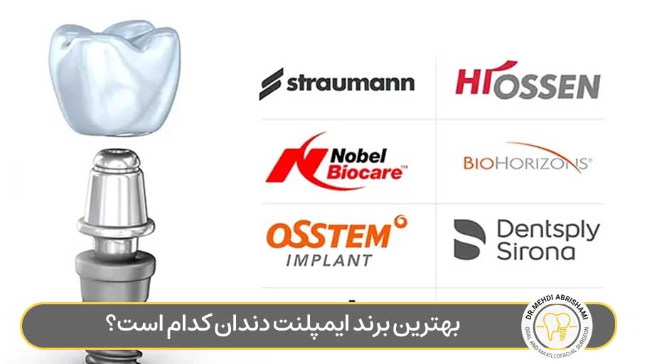 بهترین برند ایمپلنت کدام است؟