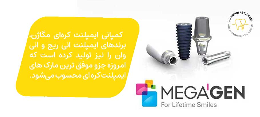 ایمپلنت کره‌ ای مگاژن (MegaGen)