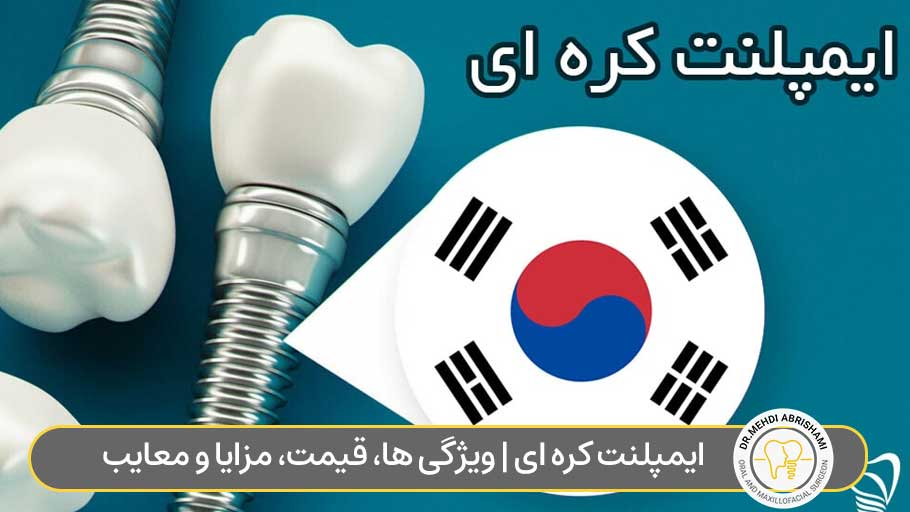 ایمپلنت کره ای | ویژگی ها، قیمت، مزایا و معایب