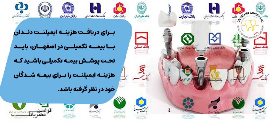 آیا در اصفهان ایمپلنت دندان تحت پوشش بیمه تکمیلی انجام می شود؟