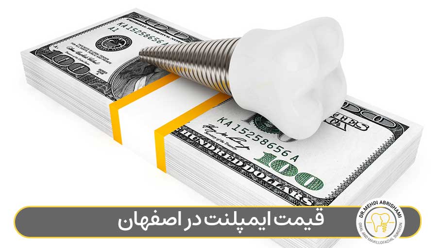 قیمت ایمپلنت در اصفهان