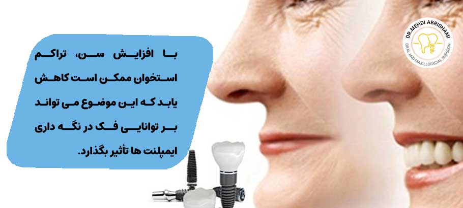 محدودیت‌ های سنی برای کاشت ایمپلنت دندان