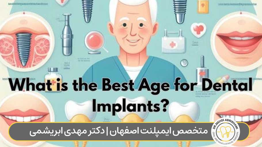 آیا کاشت ایمپلنت دندان محدودیت سنی دارد؟