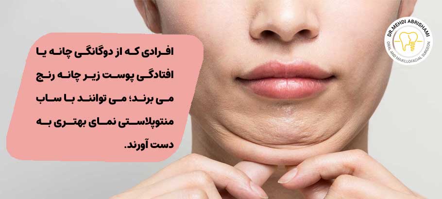 ساب منتوپلاستی چیست؟