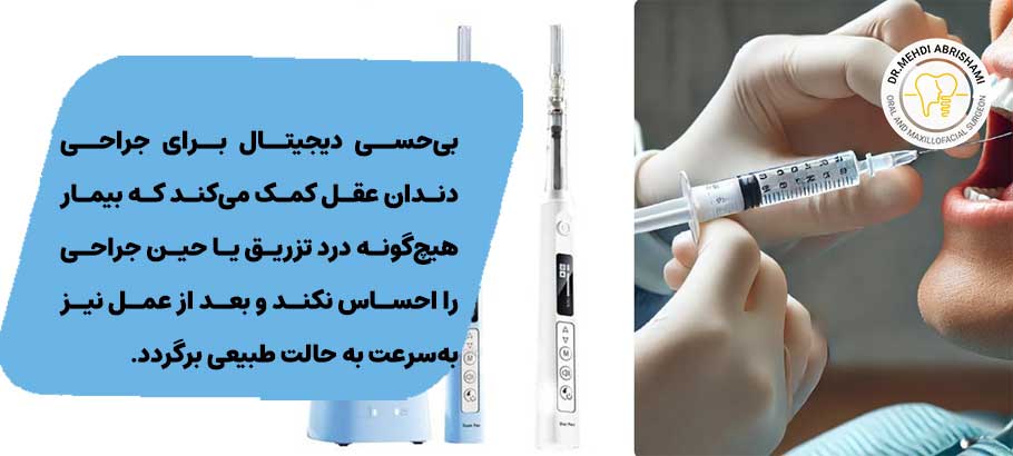 جراحی دندان عقل با لیزر در اصفهان