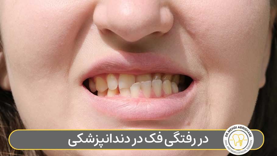 در رفتگی فک در دندانپزشکی