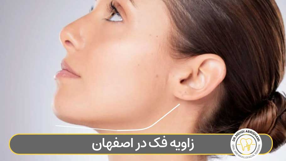 زاویه فک در اصفهان