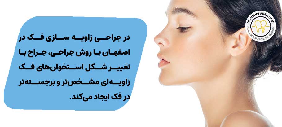 زاویه سازی فک در اصفهان