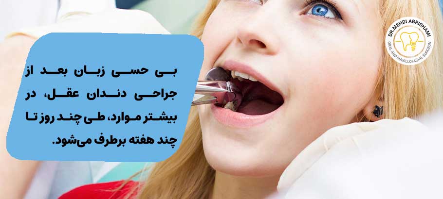بی حسی زبان بعد از جراحی دندان عقل نهفته