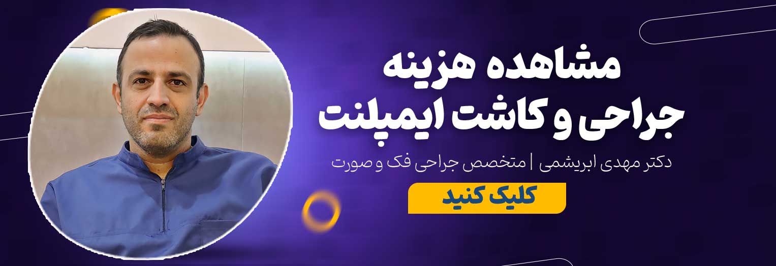 تماس با مطب دکتر مهدی ابریشمی متخصص ایمپلنت در اصفهان