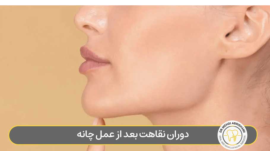 دوران نقاهت بعد از عمل چانه