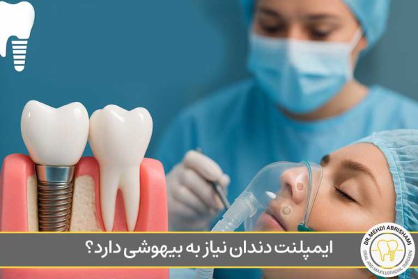 ایمپلنت دندان نیاز به بیهوشی دارد؟