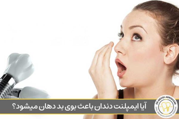 آیا ایمپلنت دندان باعث بوی بد دهان میشود؟