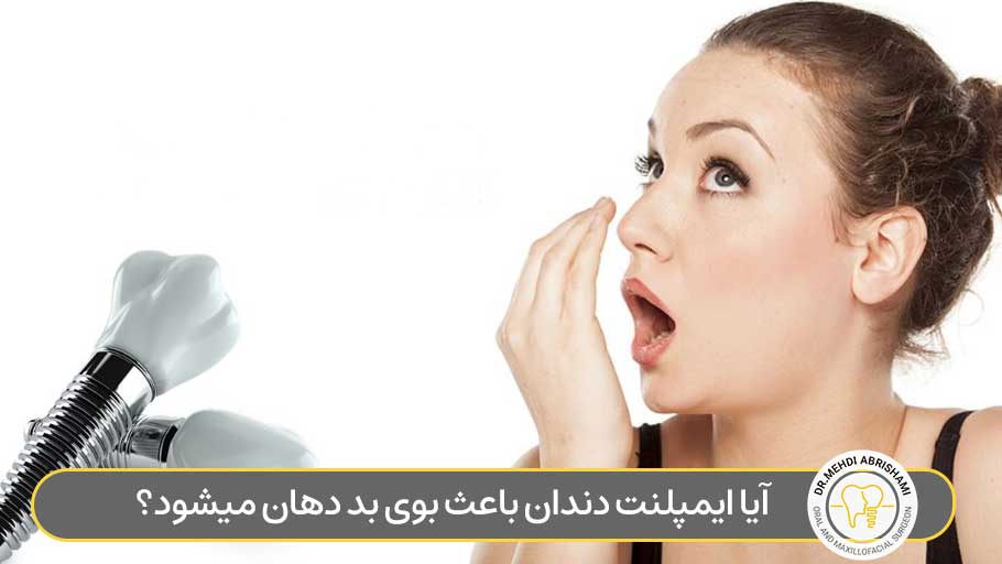 آیا ایمپلنت دندان باعث بوی بد دهان میشود؟