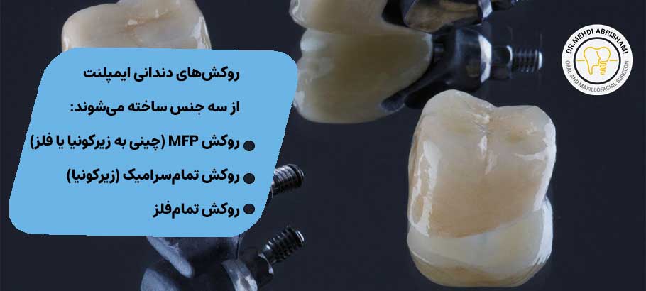 انواع روکش دندان برای ایمپلنت